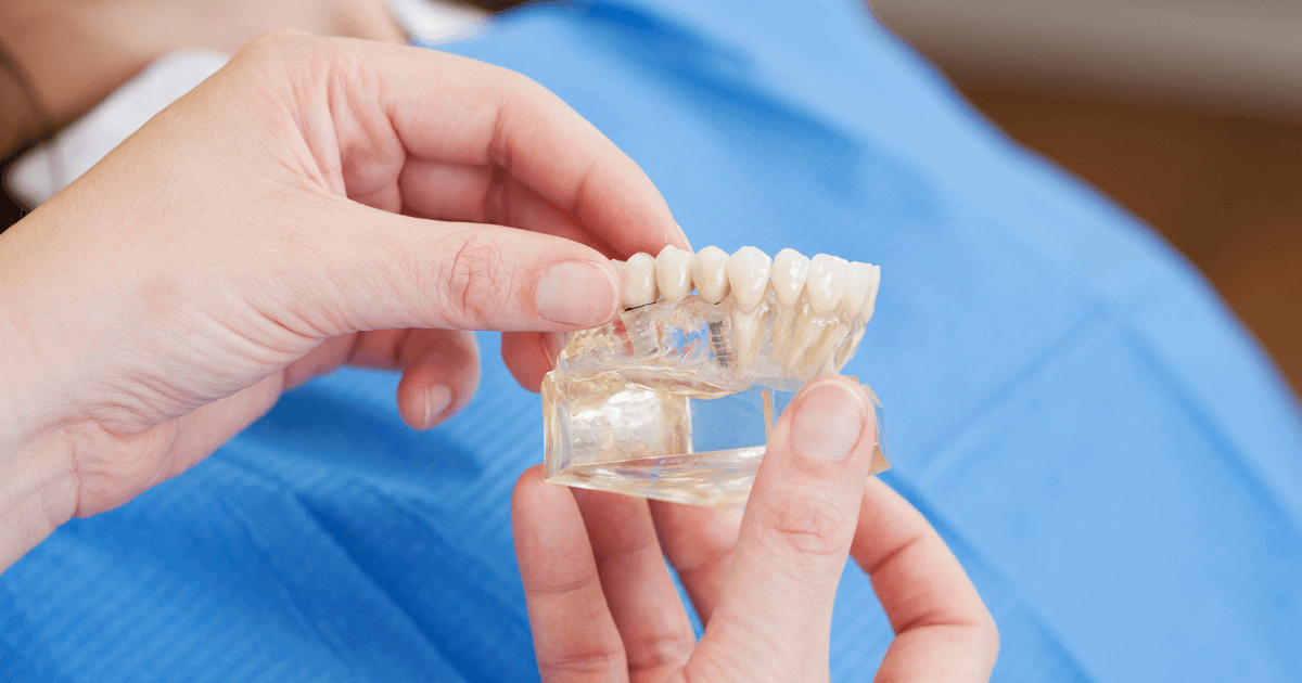 zivotnost implantatov