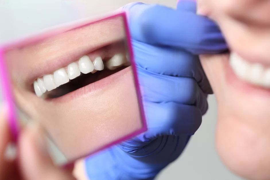 dental-bridges-and-implants-blue-light-clinic