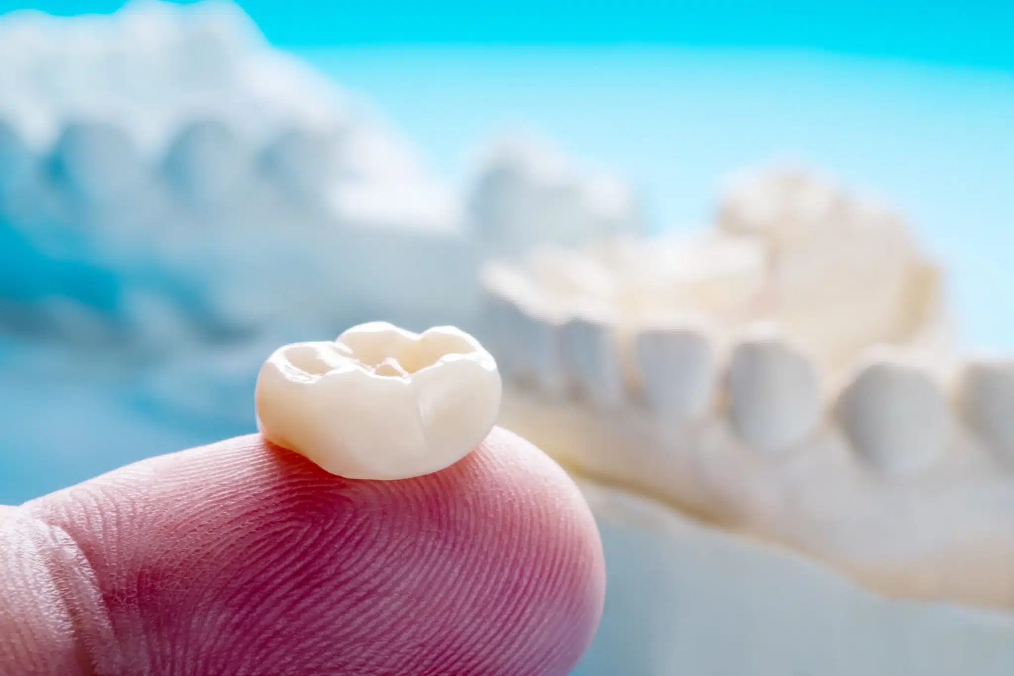 dental-crown-on-dentist-hand